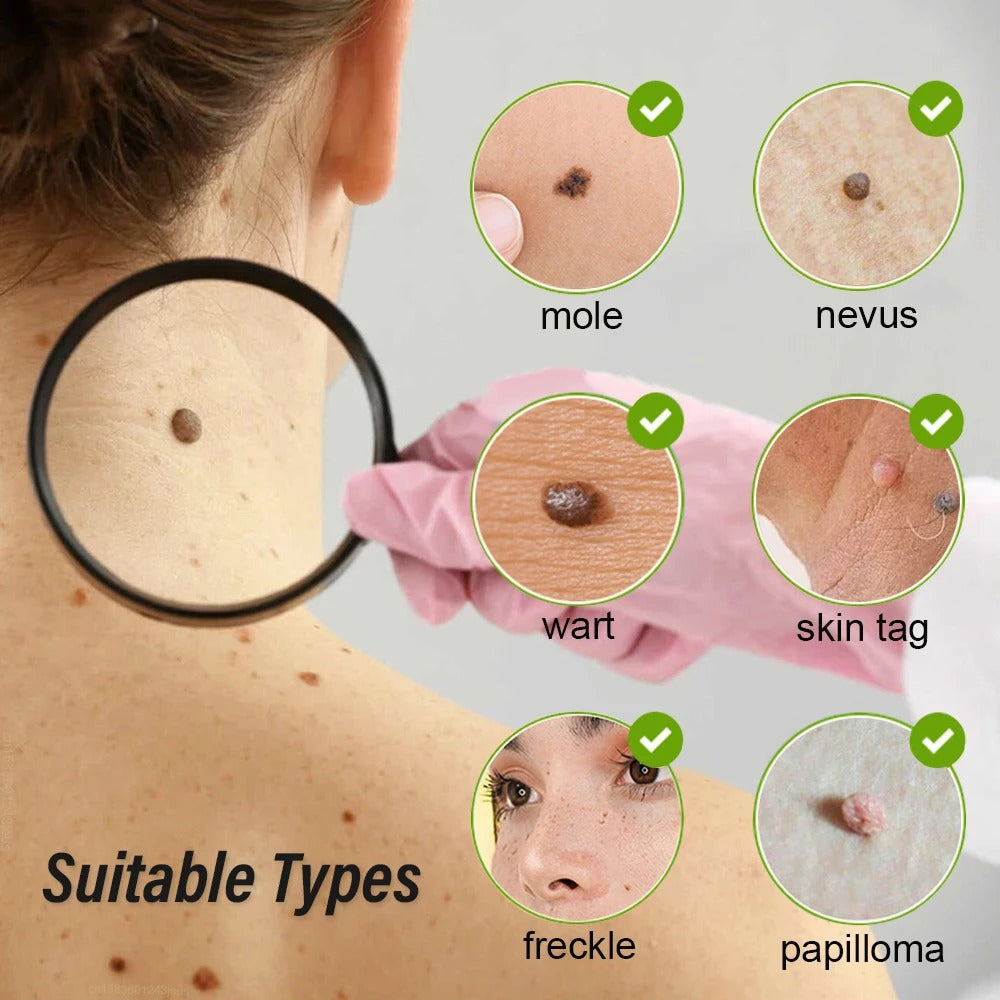 Skin Tag Remover