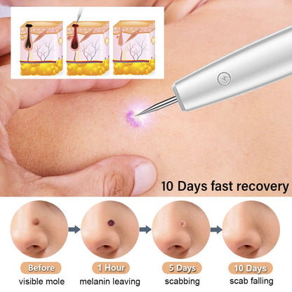 Skin Tag Remover