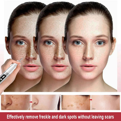 Skin Tag Remover